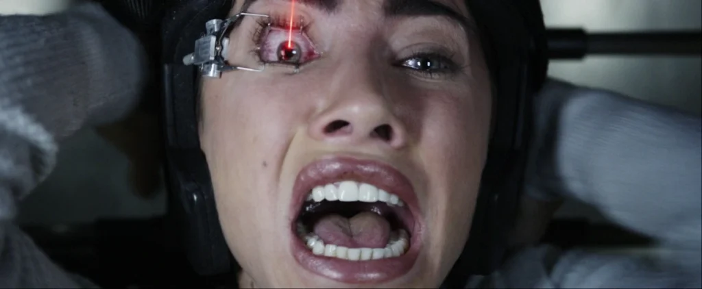 Olivia's eye surgery gone wrong